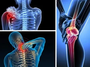 The Science of Soreness